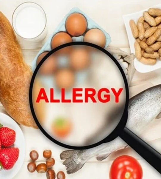 Food Sensitivities and Allergies